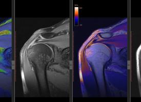 xray of shoulder