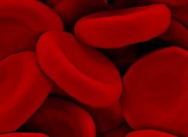 blood clot