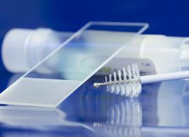 cervical screening swab
