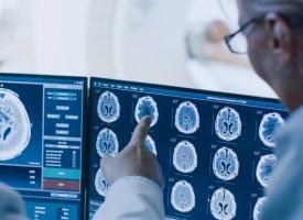 MRI