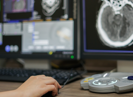 CT scan