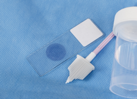 Cervical screening tools