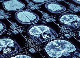 diagnostic imaging results