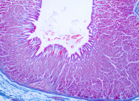 bowel screening