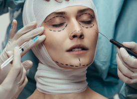 lady about to have cosmetic surgery with lines drawn on her face