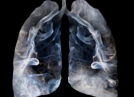 Image of lungs