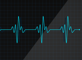 ECG reading