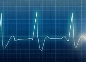 ECG reading