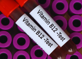 b12