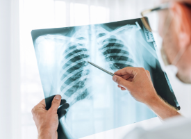 Radiology closure in Cairns
