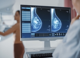 BreastScreen 