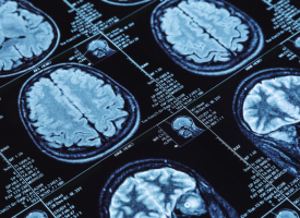 Diagnostic imaging