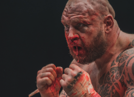 A bare-knuckle boxer with fists up, and blood all over his face
