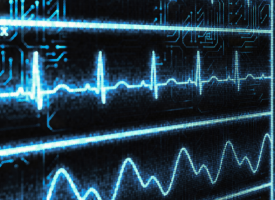 image of a cardiac test screen 