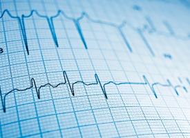 cardiac test