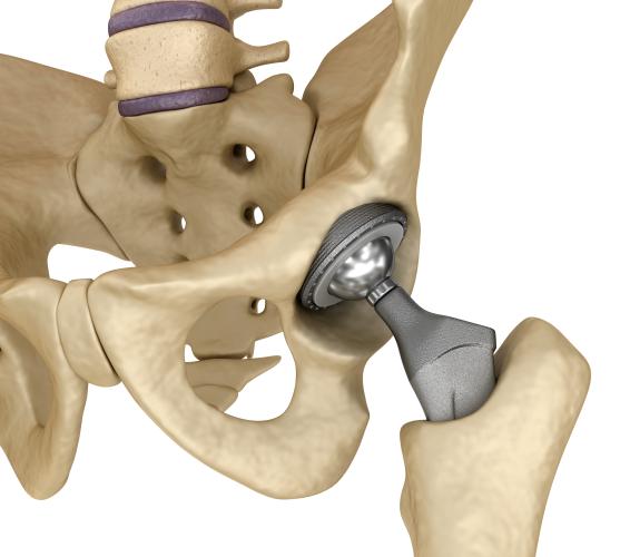 hip device