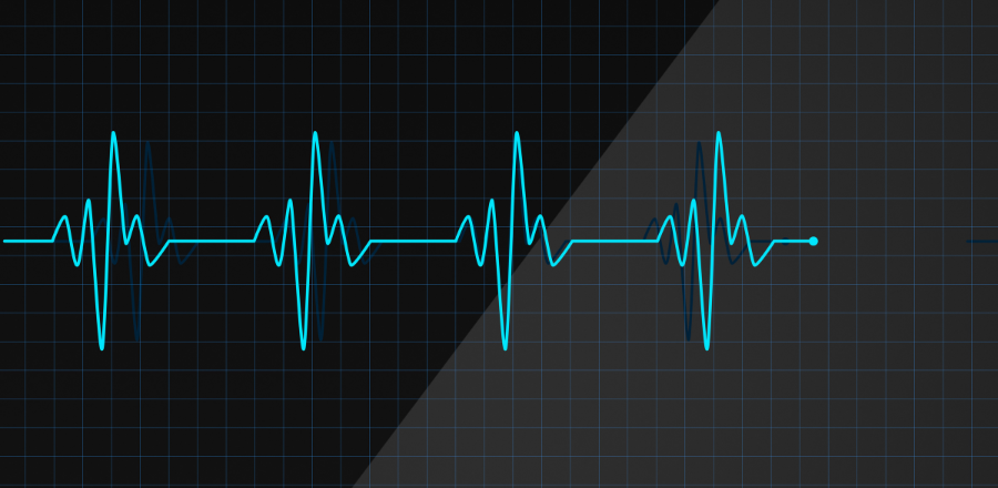 ECG reading